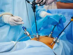 laparoscopy keyhole surgery in kenya